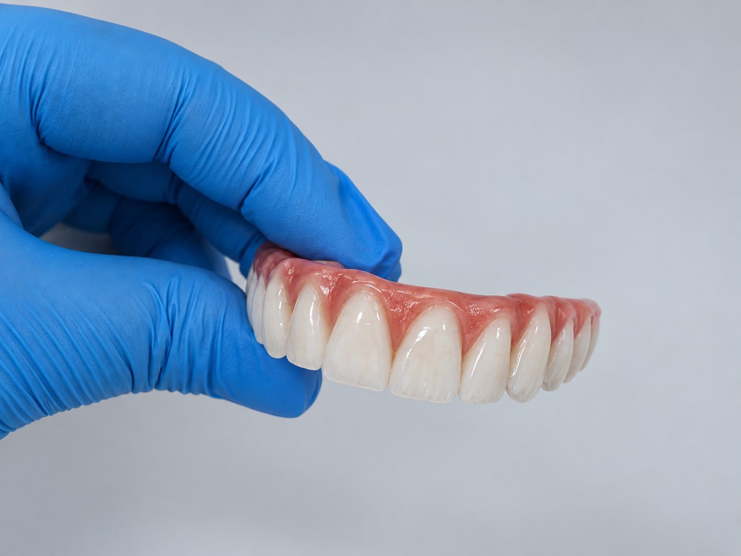 Prótese protocolo sobre implantes nas mãos da cirurgiã-dentista